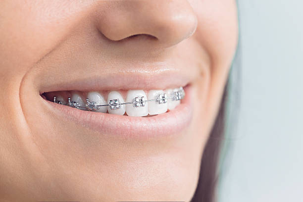 Best Dental Fillings (Composite and Amalgam)  in Cranford, NJ